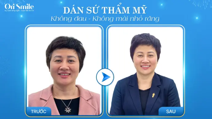 Chi tiết hình ảnh